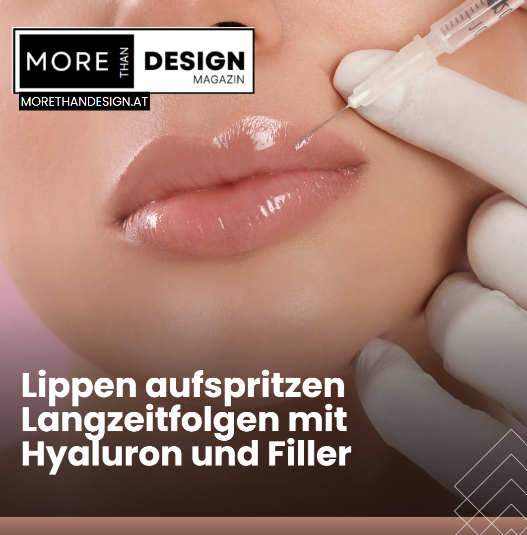 Lippen aufspritzen Langzeitfolgen mit Hyaluron und Filler – Was steckt dahinter