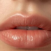 Lip Flip Botox Vorher Nachher Das Geheimnis für natürlich volle Lippen