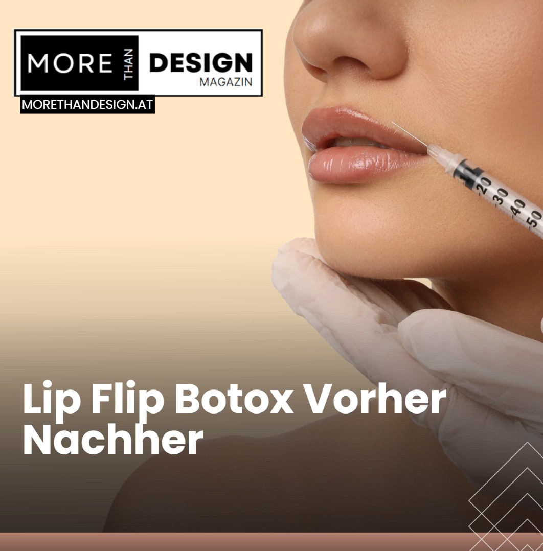 Lip Flip Botox Vorher Nachher Was Patienten erwarten können