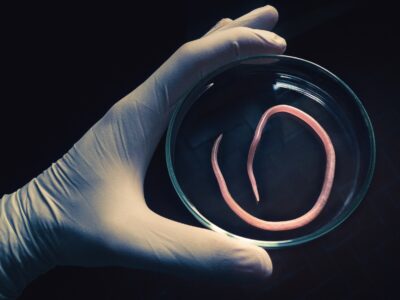 Parasiten im Körper - Symptome bei Frauen